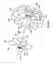 Fig. 14 - Devices and methods for gastrointestinal bypass