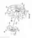Fig. 16 - Devices and methods for gastrointestinal bypass