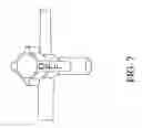 Fig. 11 - INTRAGASTRIC DEVICE
