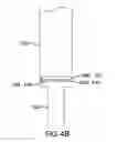 Fig. 09 - Devices and methods for gastrointestinal bypass