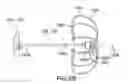 Fig. 11 - Devices and methods for gastrointestinal bypass