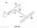 Fig. 12 - Devices and methods for gastrointestinal bypass