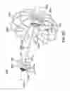 Fig. 13 - Devices and methods for gastrointestinal bypass
