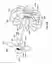 Fig. 14 - Devices and methods for gastrointestinal bypass
