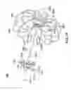 Fig. 15 - Devices and methods for gastrointestinal bypass