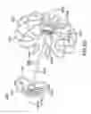 Fig. 16 - Devices and methods for gastrointestinal bypass