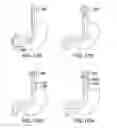Fig. 25 - Devices and methods for gastrointestinal bypass