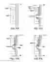 Fig. 26 - Devices and methods for gastrointestinal bypass