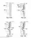 Fig. 32 - Devices and methods for gastrointestinal bypass
