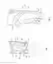 Fig. 02 - Orthopedic device for treating complications of the hip