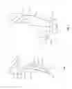 Fig. 03 - Orthopedic device for treating complications of the hip