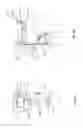 Fig. 07 - Orthopedic device for treating complications of the hip