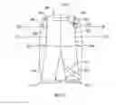 Fig. 10 - Orthopedic device for treating complications of the hip