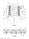Fig. 11 - Orthopedic device for treating complications of the hip