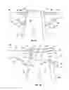 Fig. 14 - Orthopedic device for treating complications of the hip