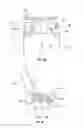 Fig. 15 - Orthopedic device for treating complications of the hip