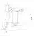 Fig. 23 - Orthopedic device for treating complications of the hip