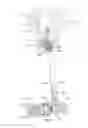Fig. 25 - Orthopedic device for treating complications of the hip