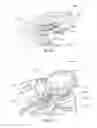 Fig. 26 - Orthopedic device for treating complications of the hip