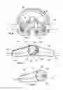 Fig. 32 - Orthopedic device for treating complications of the hip
