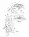 Fig. 33 - Orthopedic device for treating complications of the hip