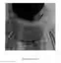 Fig. 01 - DOUBLE SOFT COLLAR