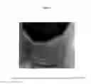 Fig. 02 - DOUBLE SOFT COLLAR