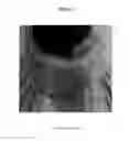 Fig. 04 - DOUBLE SOFT COLLAR