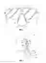 Fig. 02 - Eyewear system for securing lens on a user's nose and dilating user's nose