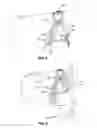 Fig. 06 - Eyewear system for securing lens on a user's nose and dilating user's nose