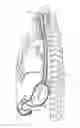 Fig. 01 - Apparatus and Method Of Gastric Cooling Using Balloon Catheter