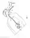 Fig. 02 - Apparatus and Method Of Gastric Cooling Using Balloon Catheter