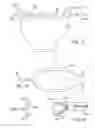 Fig. 13 - Pre-loaded injector for use with intraocular lens