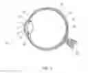 Fig. 02 - Methods and patterns for increasing amplitude of accommodations in a human lens