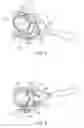 Fig. 04 - Gonio lens system with stabilization mechanism