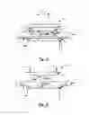 Fig. 05 - Apparatus for applying multi-dimensional traction to the spinal column