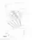 Fig. 03 - Device, system and method for compression treatment of a body part