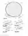 Fig. 17 - Device, system and method for compression treatment of a body part
