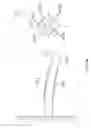 Fig. 06 - Rehabilitation system with stiffness measurement