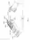 Fig. 07 - Rehabilitation system with stiffness measurement
