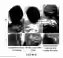 Fig. 09 - TISSUE REPAIR DEVICES UTILIZING SELF-ASSEMBLED MATERIALS