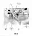 Fig. 09 - Pill feeder