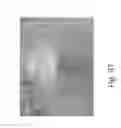 Fig. 104 - Stable silk protein fragment compositions