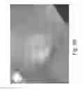 Fig. 106 - Stable silk protein fragment compositions