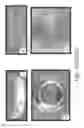 Fig. 54 - Stable silk protein fragment compositions