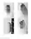 Fig. 02 - Tablet comprising crospovidone