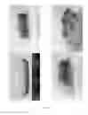 Fig. 03 - Tablet comprising crospovidone