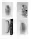 Fig. 04 - Tablet comprising crospovidone