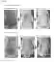Fig. 04 - Composition containing monoacetyldiglyceride compound as active ingredient for preventing or treating atopic dermatitis