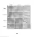 Fig. 05 - Composition for treating immune diseases containing daurinol compound as active ingredient